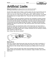 Science, Technology, and Society: Artificial Limbs